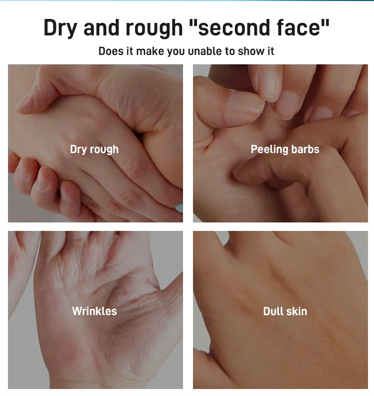 Japan Imported Niacinamide Whitening Hand Cream Lighten melanin