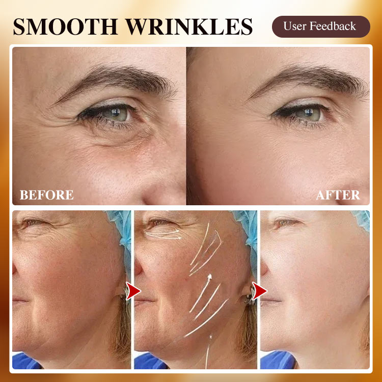 New Year Promo-Buy 1 Take 1-Gold Collagen Anti-Wrinkle Cream-Firm and lighten lines, whiten and lighten spots. The secret to restoring youthful skin