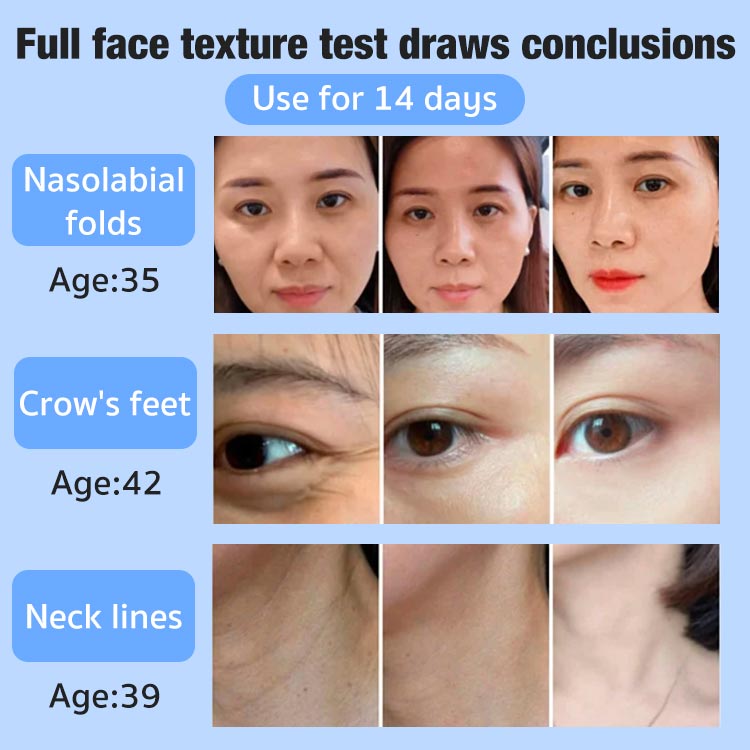 Japanese 28-day anti-wrinkle rejuvenation cream-Recommended by dermatologists and beauty salon doctors-Buy 1 Take 1